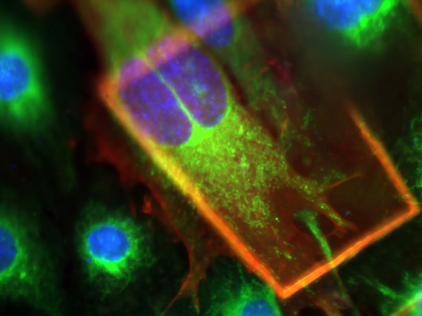 Cryofluorescence image of mouse embryonic fibroblast cells taken at the workshop. The cell nuclei are shown in blue, mitochondria in green and filamentous actin in red. 