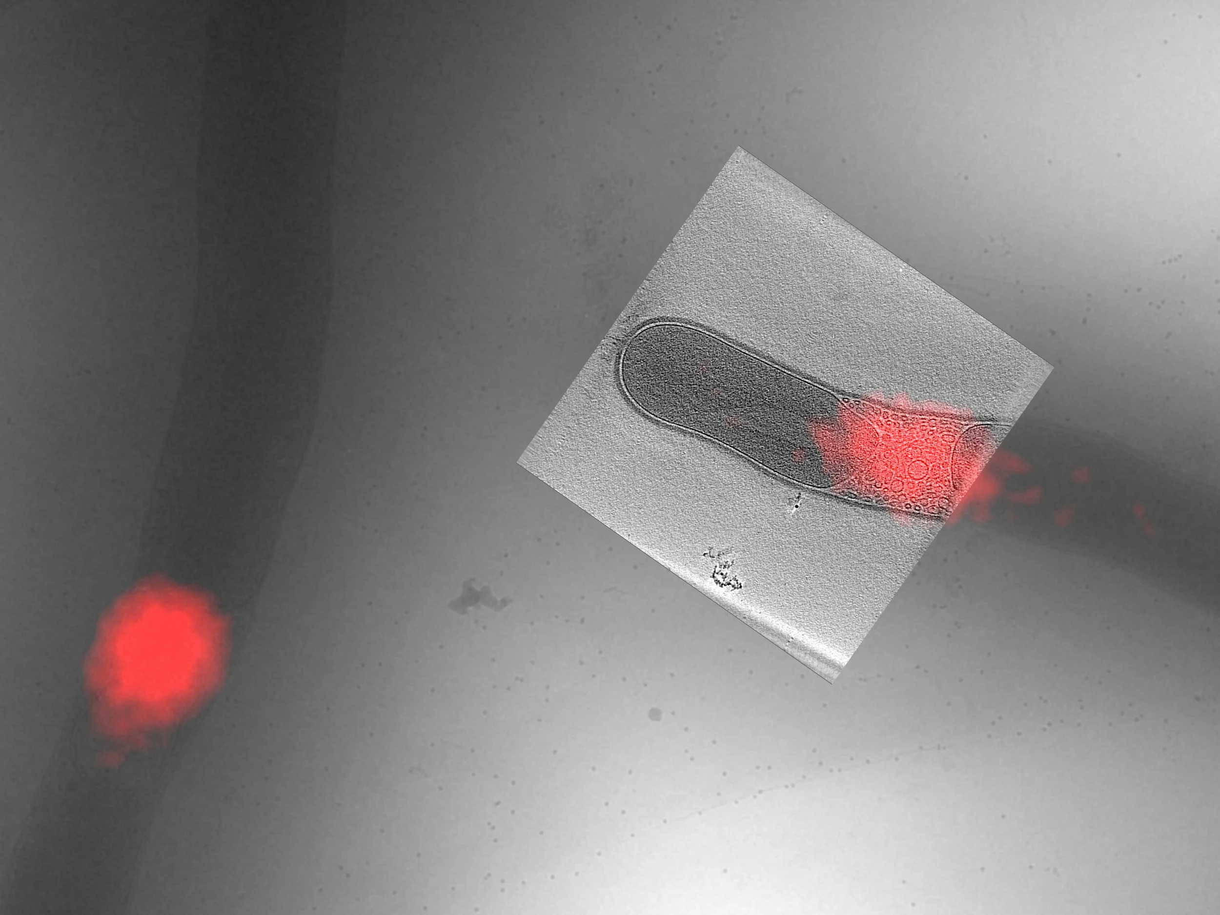 Cryo-CLEM is an imaging technique which combines the best of fluorescence and cryo electron microscopy for high resolution imaging (image courtesy of Roman Koning, Leiden University Medical Centre).