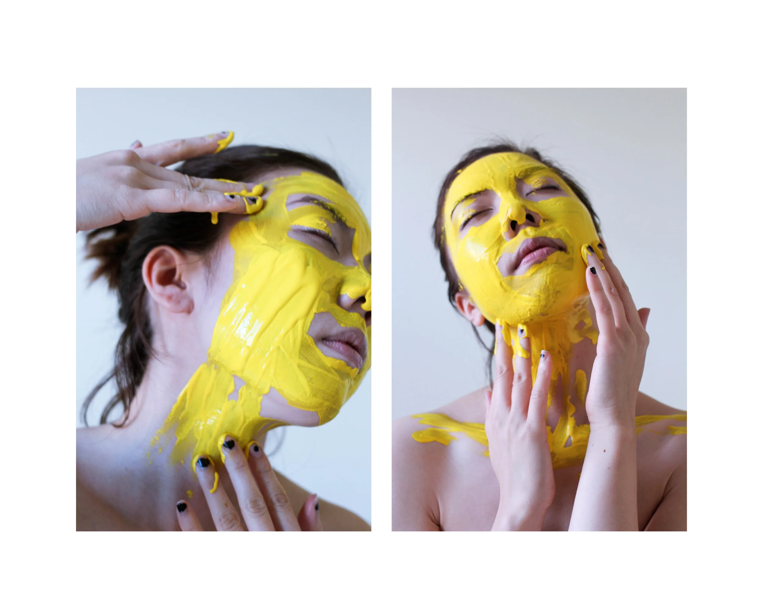 Kim Nguyen, Yellow Fever