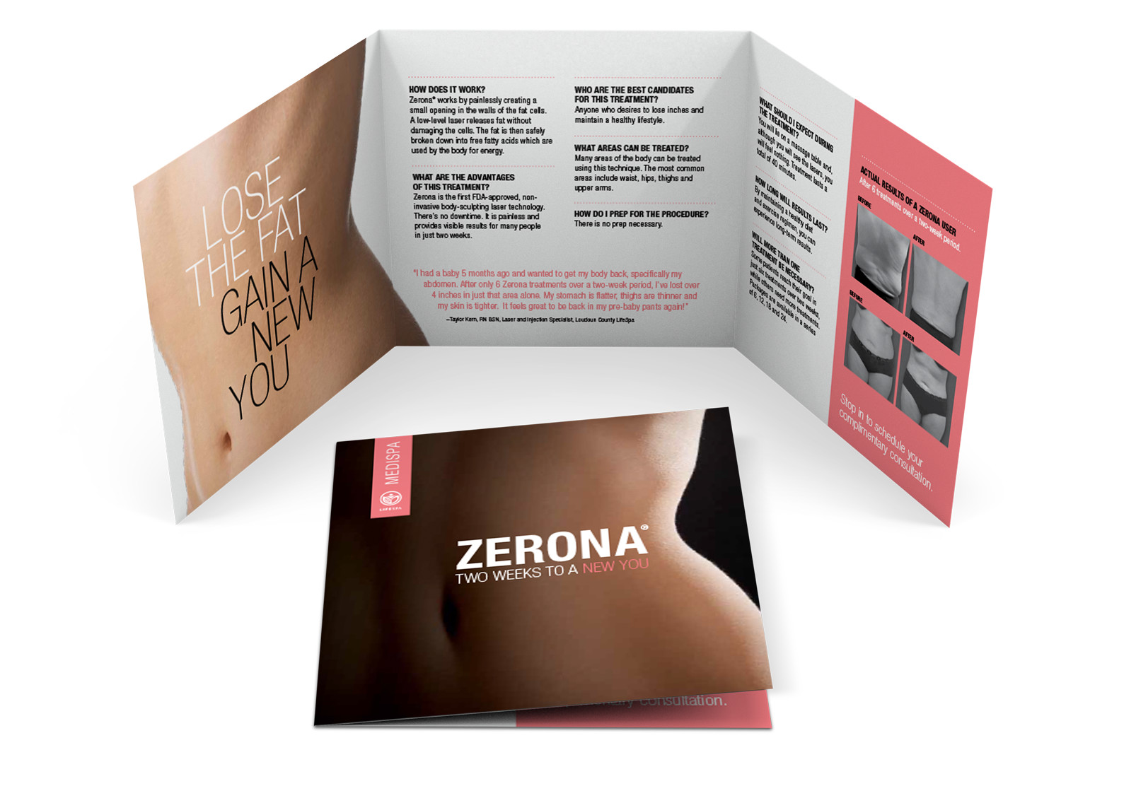 zerona brochure.jpg