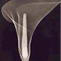 X-ray by Dr. Dain Tasker (1930)