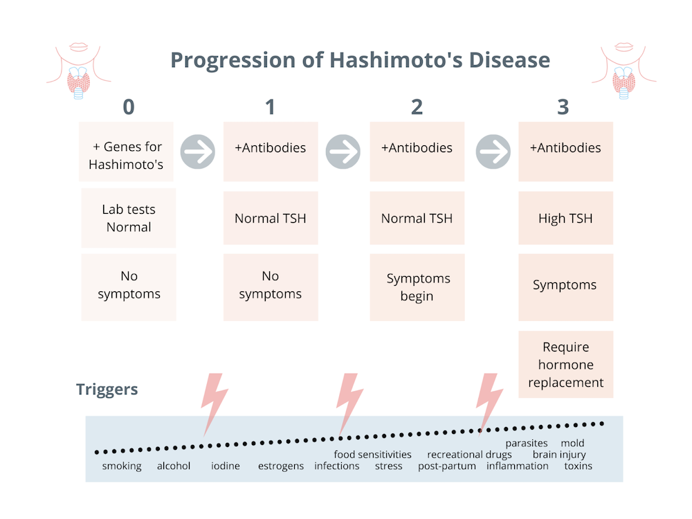 Testing Hashimoto About Hashimoto’S _ Hashimoto’s Disease: What It Is, Symptoms ...
