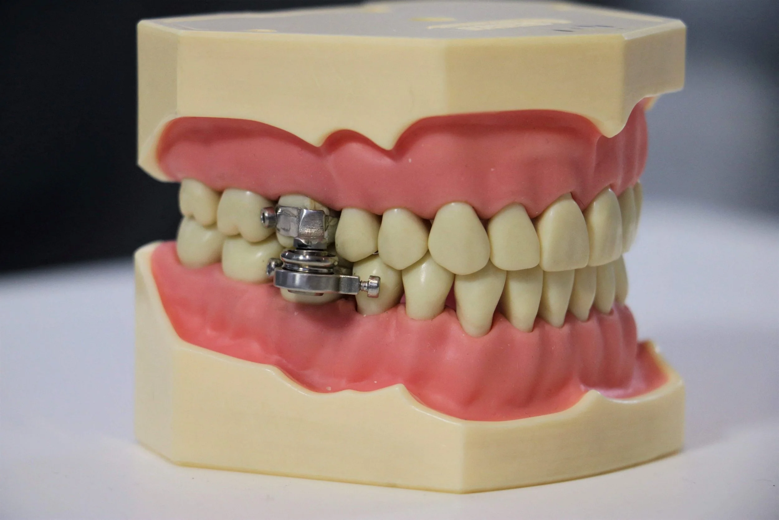 The DentalSlim Diet Control - a jaw wiring device that uses magnets, which was released in 2021.