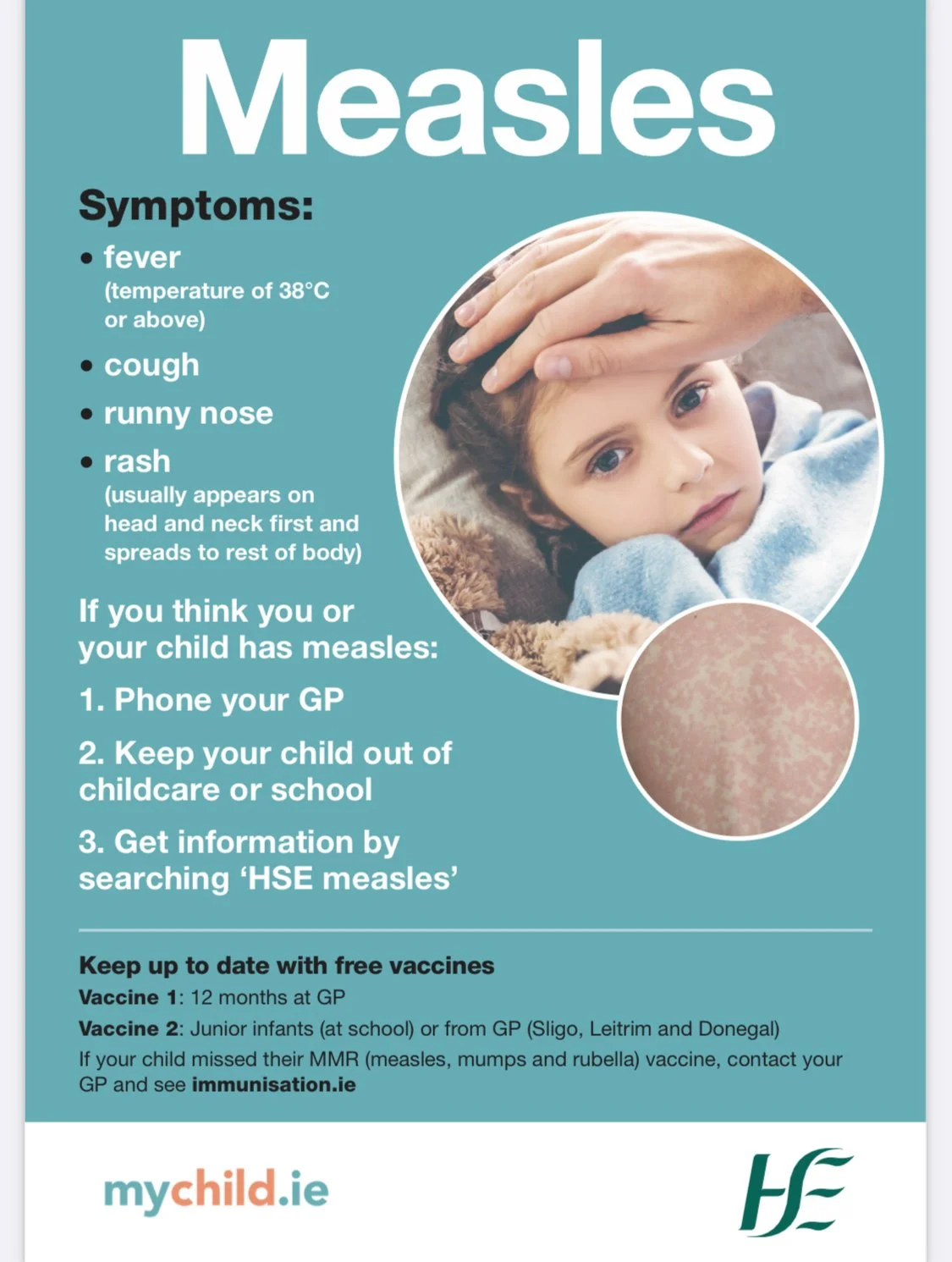 Measles symptoms from the HSE