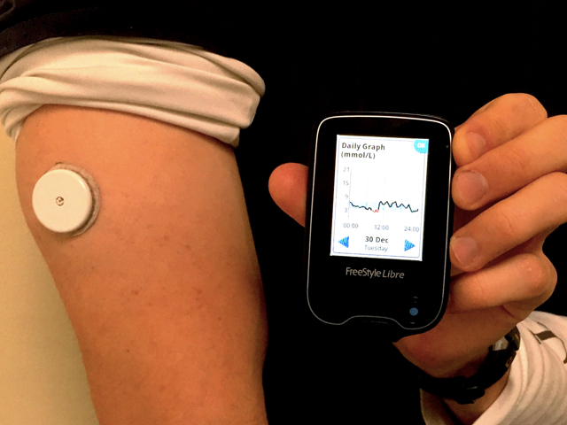 Understanding my Blood Glucose