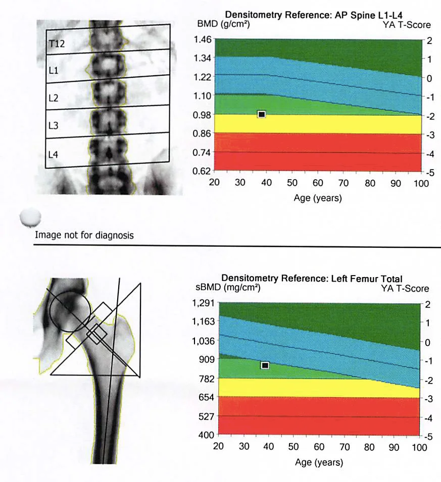 DEXA_scan_2013.jpg