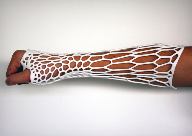 medicalschool:

3D-printed ‘Cortex’ cast concept puts a modern spin on bone fracture treatment
To anyone that’s ever broken a bone, the negatives of traditional plaster casts are familiar: they’re cumbersome, heavy, and can get rather smelly. Victor…