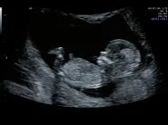 Baby Lambton coming November 2016!!