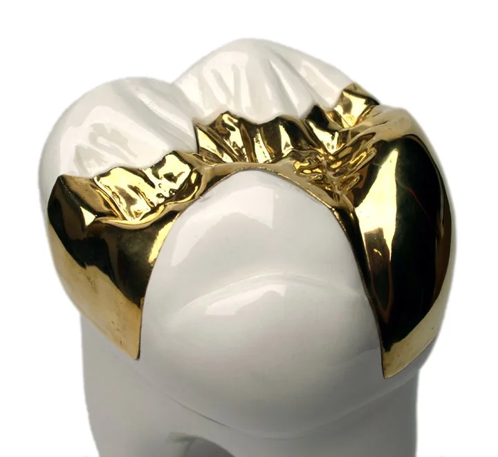 gold tooth close sm.jpg