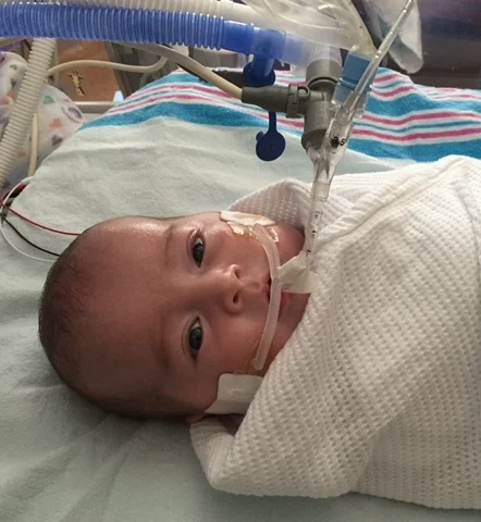 Before Adelyn's Tracheotomy/G-Tube Surgery