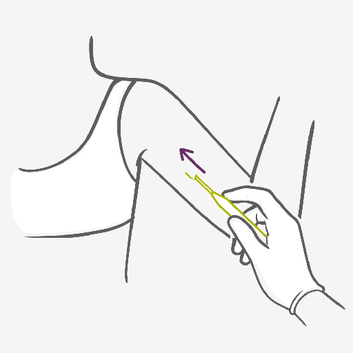 implant2.png