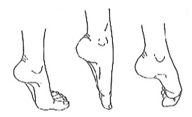 Toe.jpg