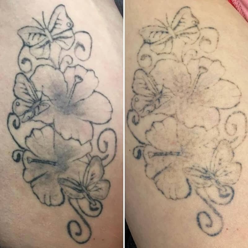 Can You Get A Tattoo Touched Up After 2 Weeks? 