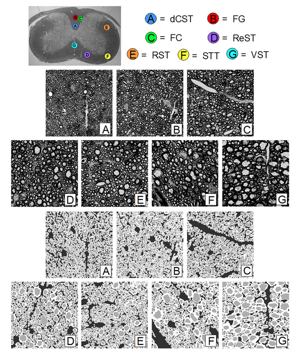  Optical image of&nbsp;mouse cord section showing WM tract locations and their&nbsp;segmented axons 