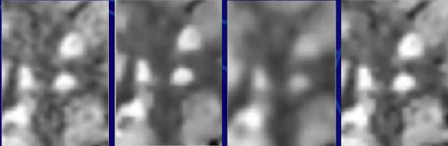  Zoomed in regions for the above images 