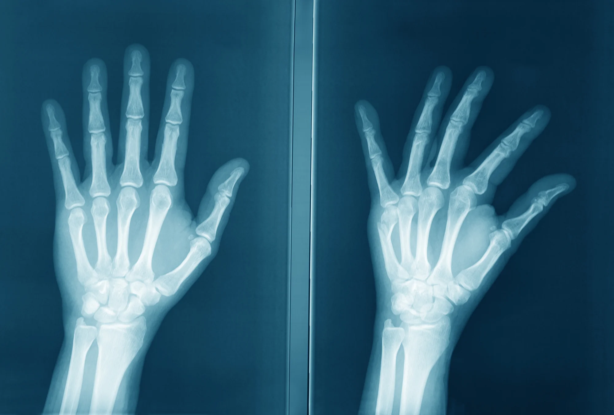 handandwrist.jpg