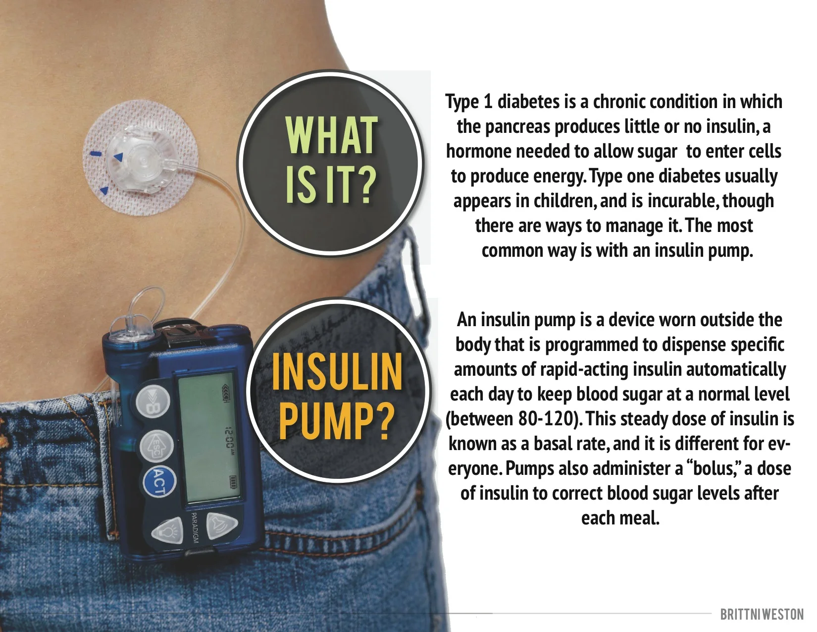 Diabetic Research-page5.jpg