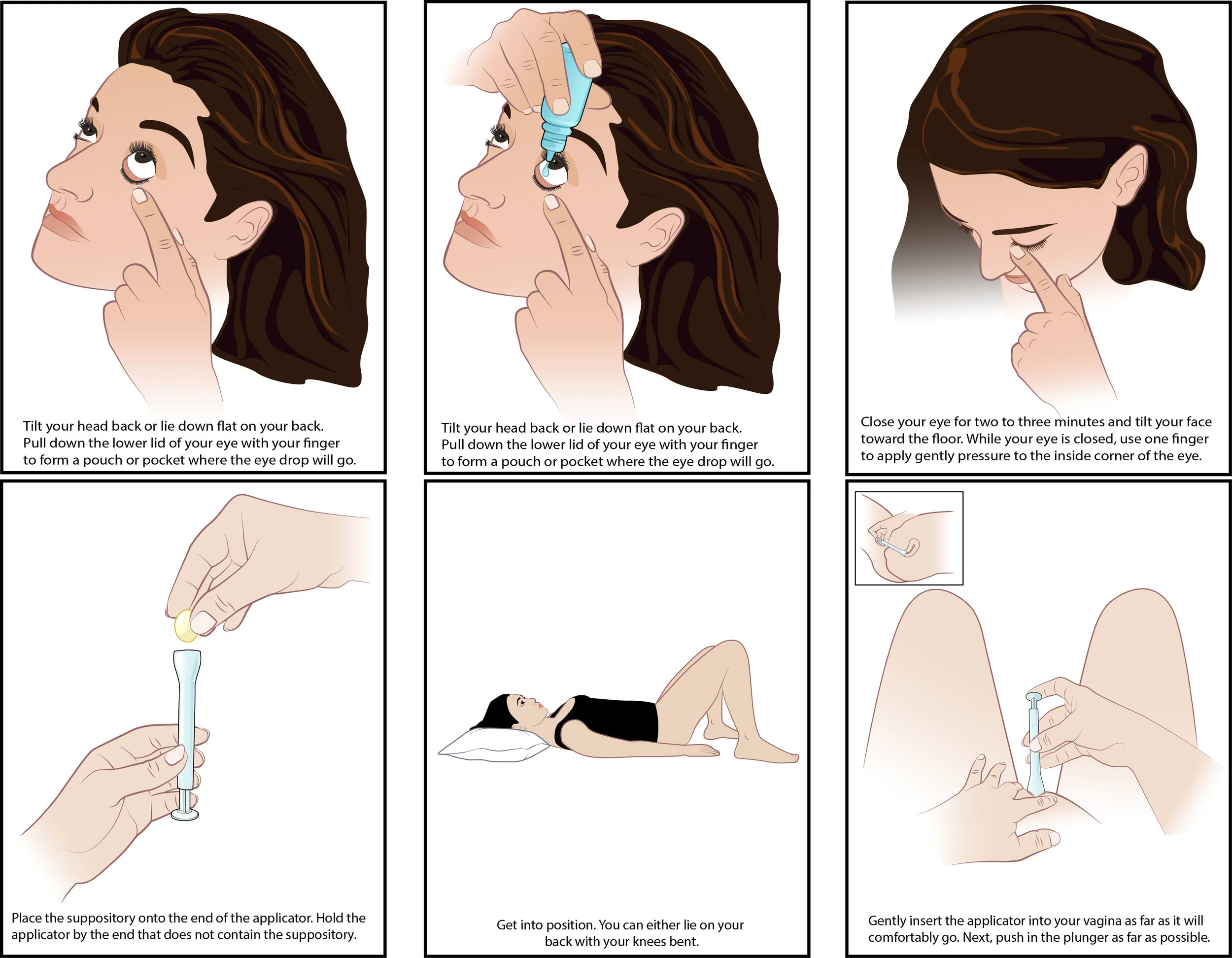 illustration showing the steps of administering eye drops and vaginal Suppositories commissioned by Healthline.com Adobe Illustrator 2016