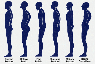 Correct Posture: Critical for Good Health