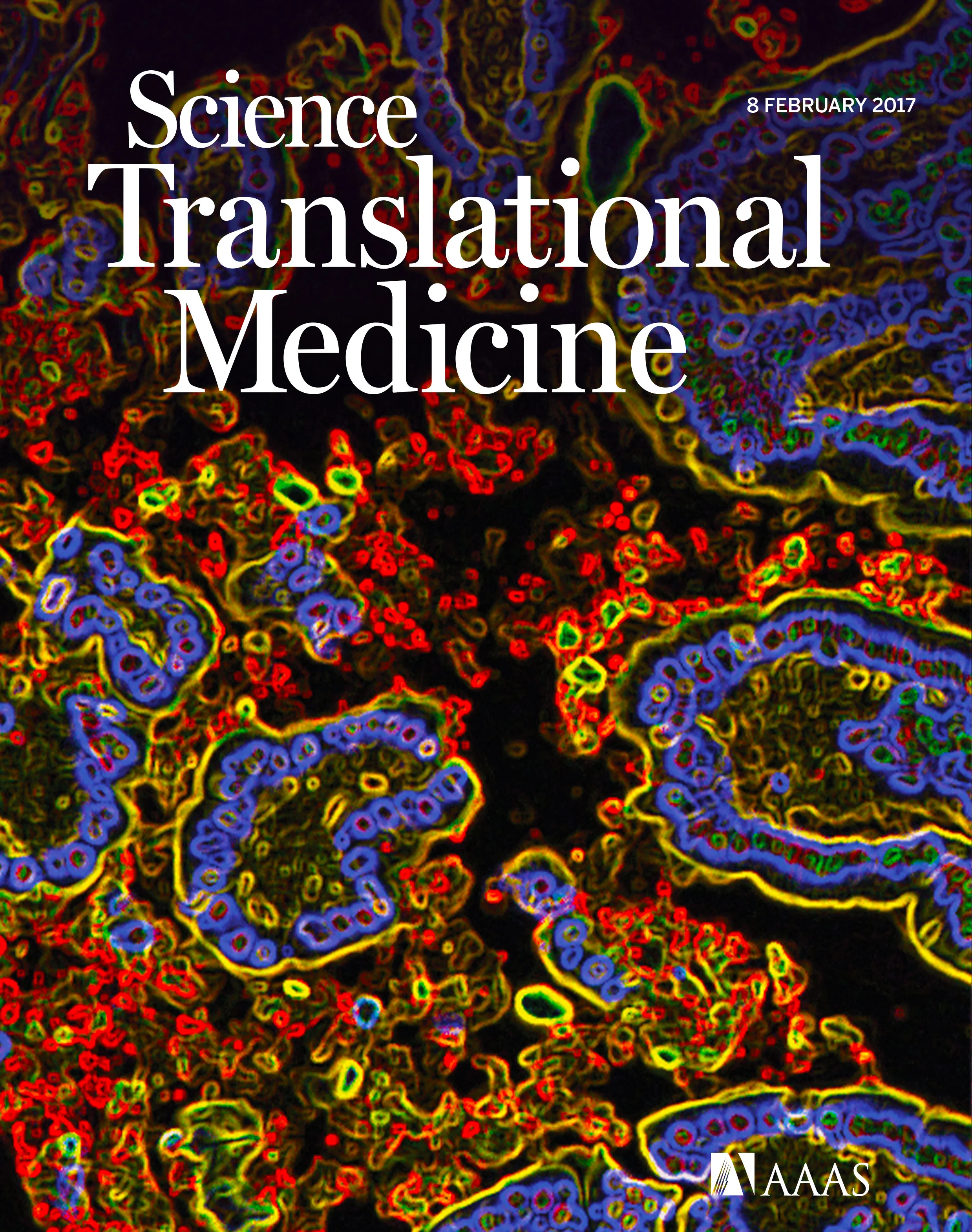 bum Joints . Intestinal Bacteria link mucosal and systemic immunity.