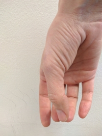 Hand hangs down naturally