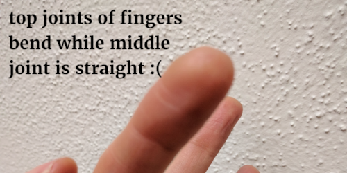 Buckling Fingers Double Joints Playing The Cello While Hypermobile Cello Practice Cello Performance