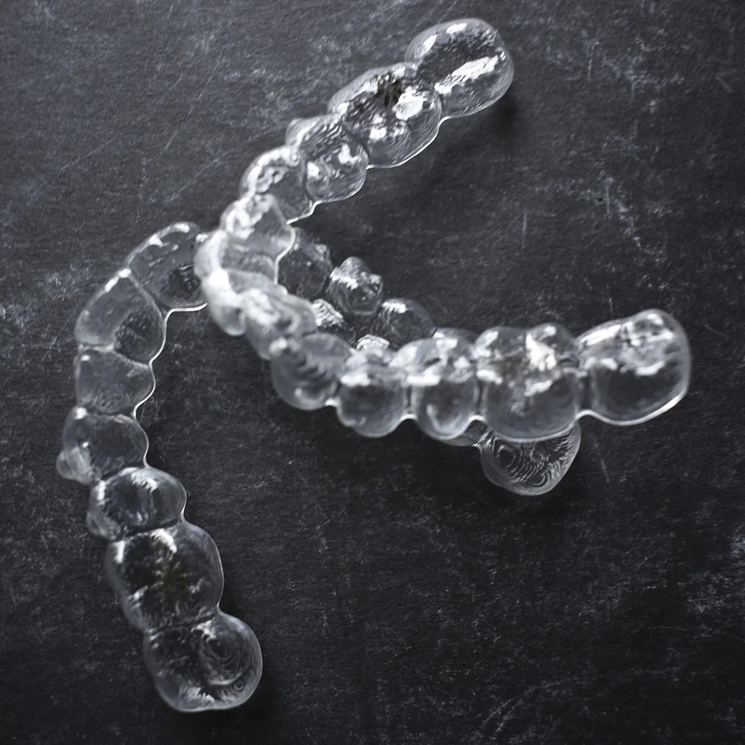 Braces.jpg
