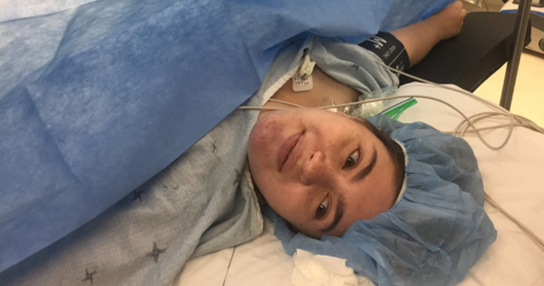 c-section (2).png