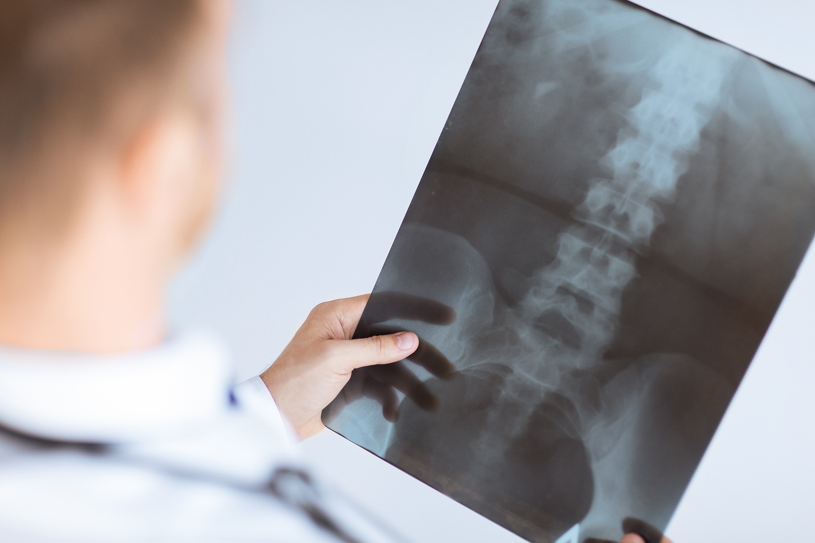 Our North ryde chiropractor can take x-rays