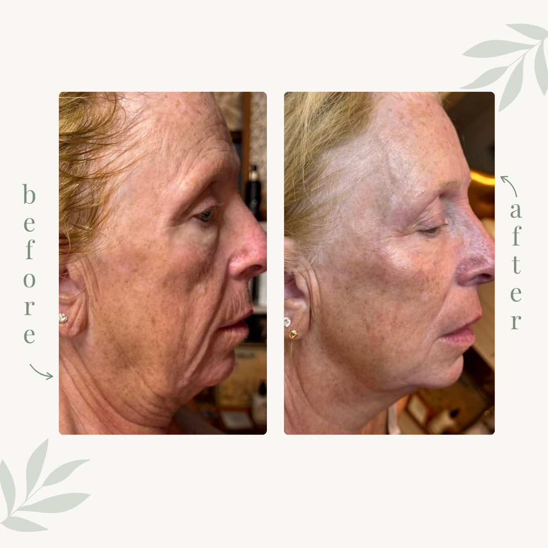 Skincare and Organic Facials — Pure Eco Spa & Boutique | Westerly, RI