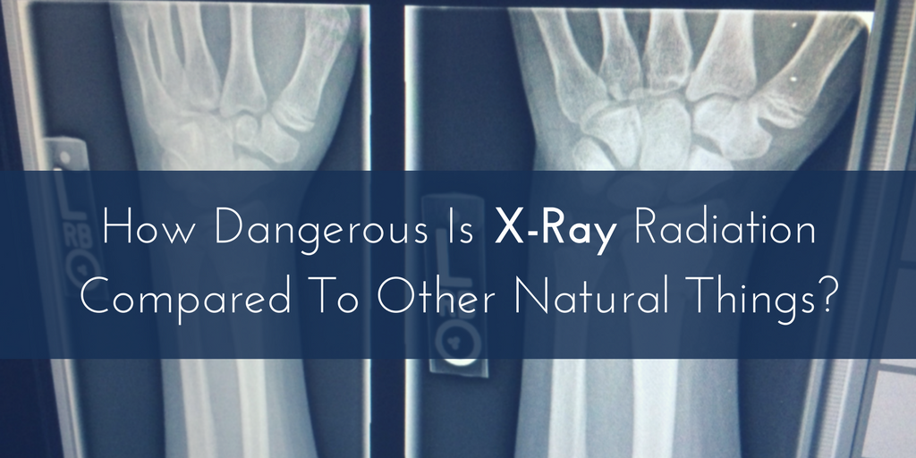 X Ray Radiation >> How Dangerous Is X Ray Radiation Compared To Other Natural X Ray Radiation >> How Dangerous Is X Ray Radiation Compared To Other Natural