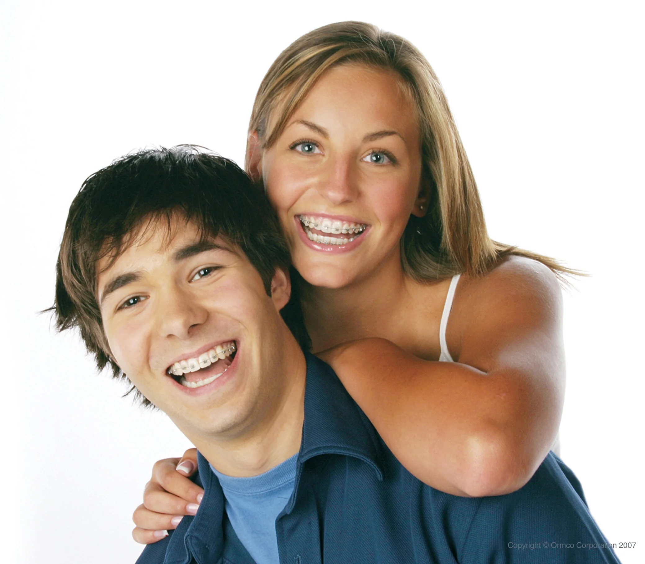 Model Patients are wearing Damon braces - Image provided by ormco