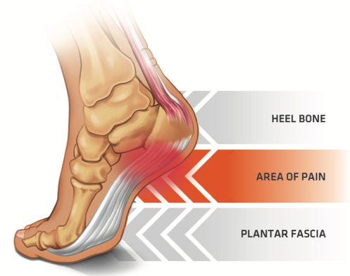 heel pain after walking