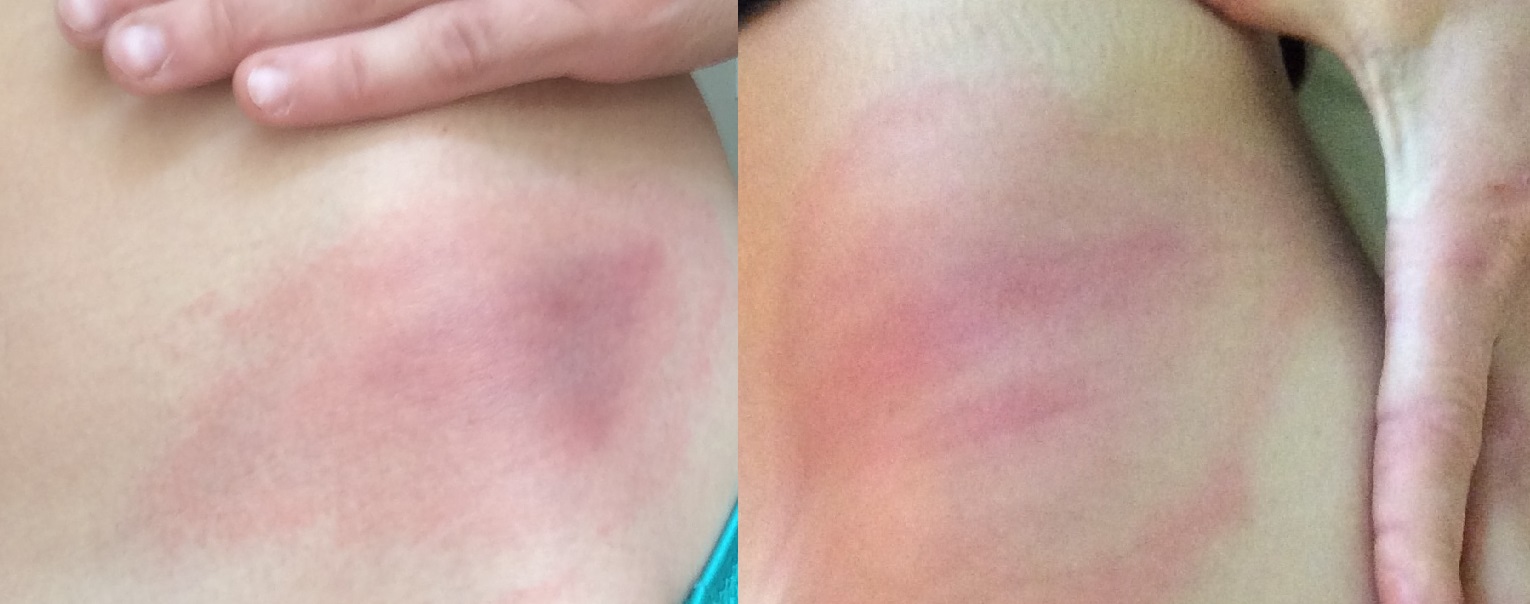 A two day difference