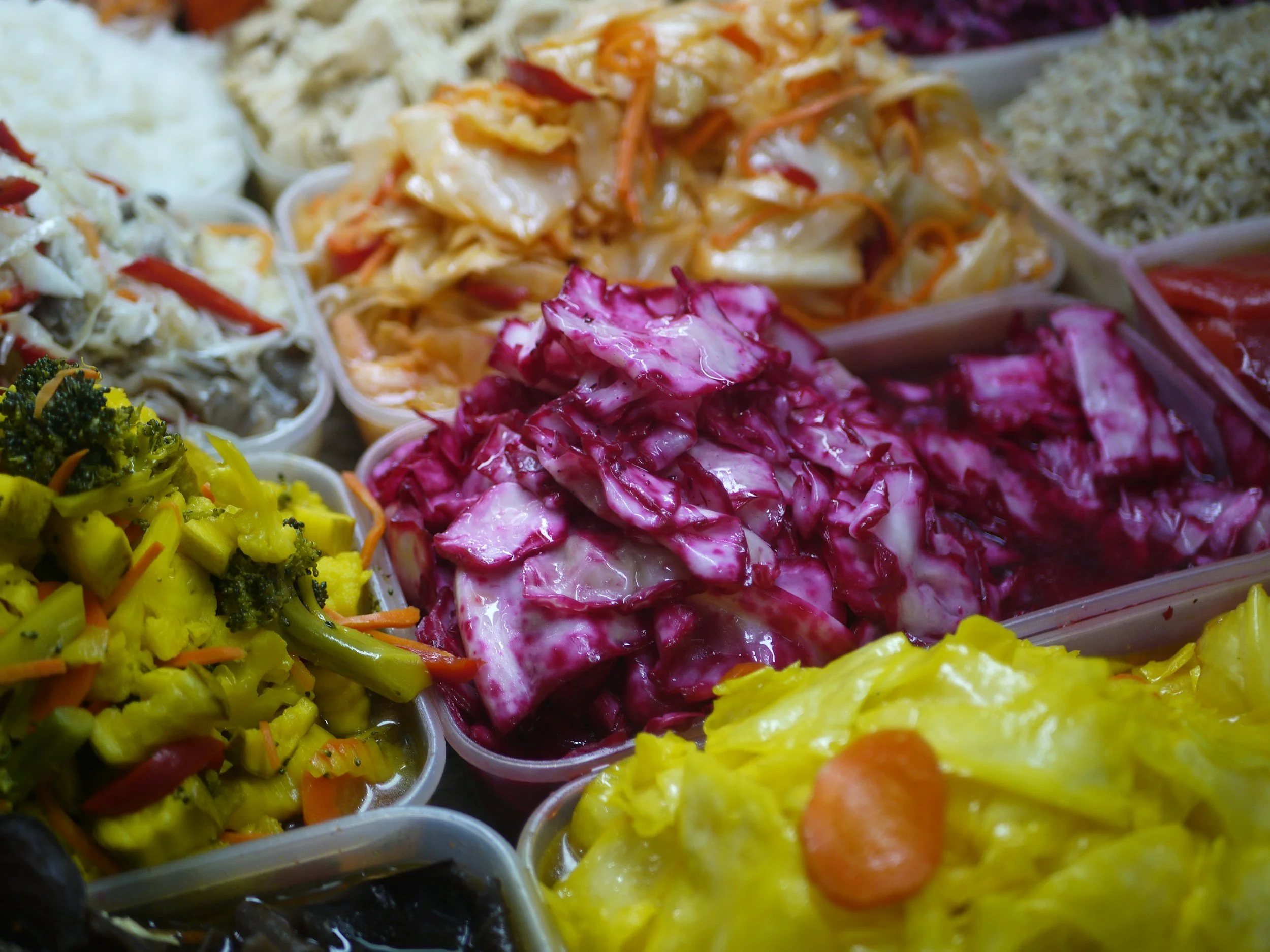 The Gut-Brain Connection: How Digestive Health Supports Mental Wellness