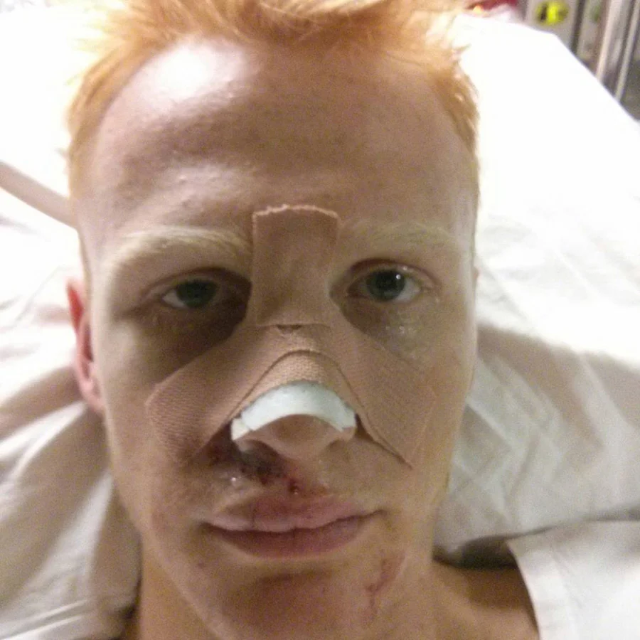 Kian on the mend at Epping Hospital...