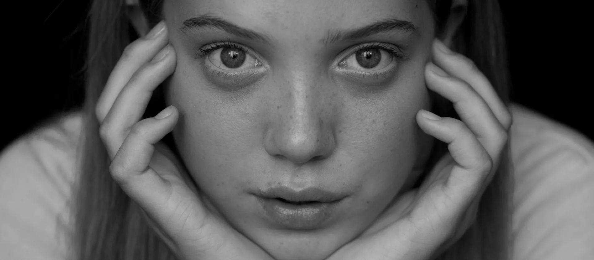 Girl with freckles holding her face in her hands