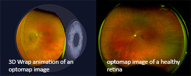 optomap-home-page.jpg