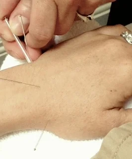 kenton wellness cooperative offers acupuncture.