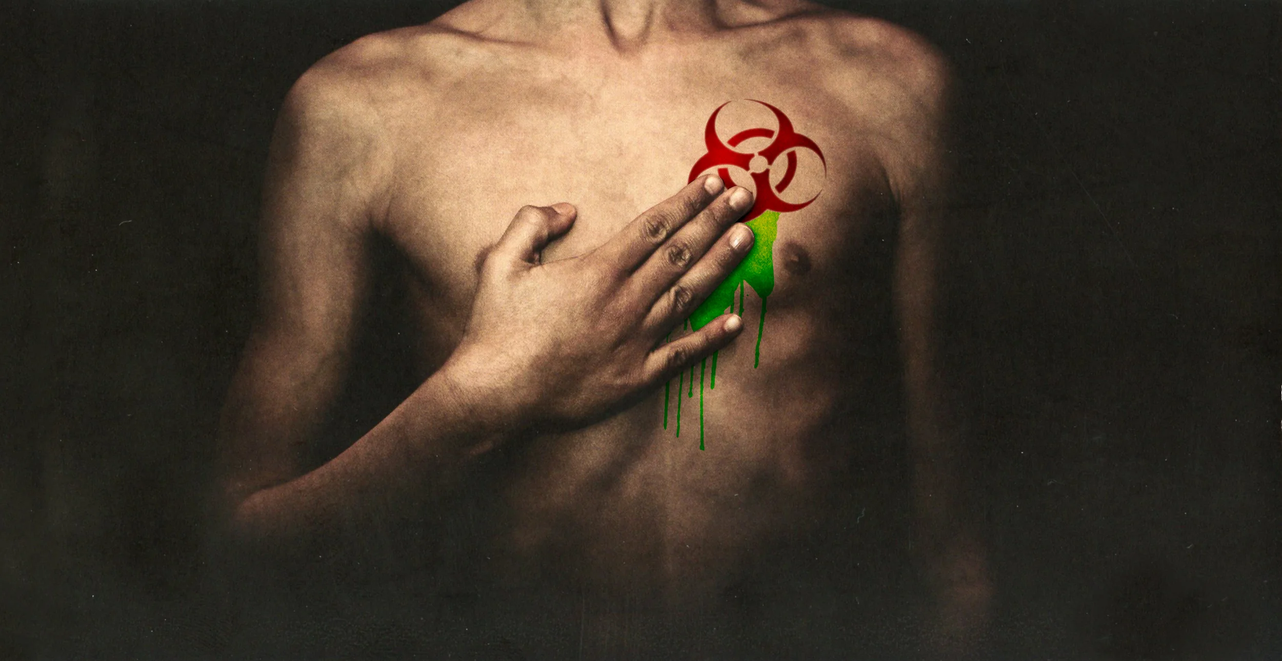 chest_toxic2.jpg