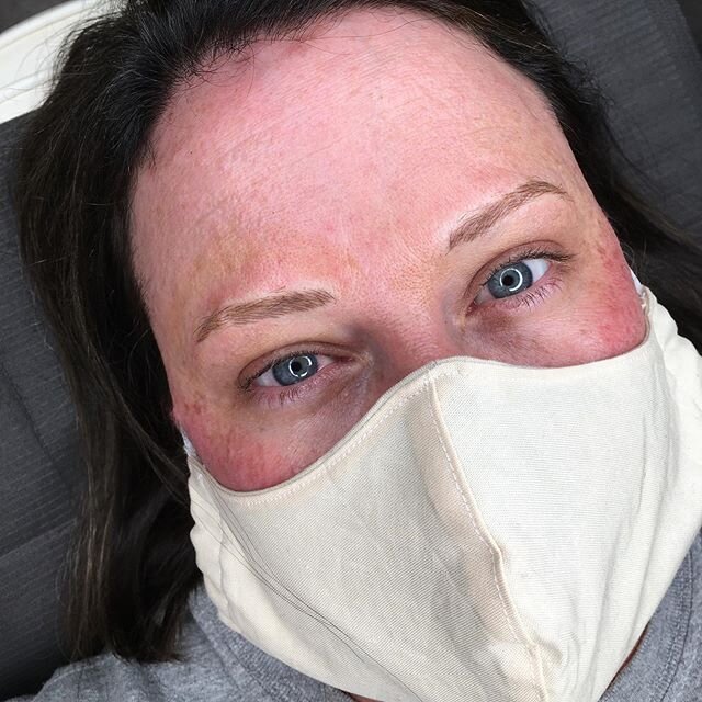 First photo is healed!! This is after only one session. Make sure when you research and stalk your potential permanent makeup artists (yes, please stalk my posts and photos!!) you see healed results. If you don&rsquo;t see any, ask!

Second photo is 