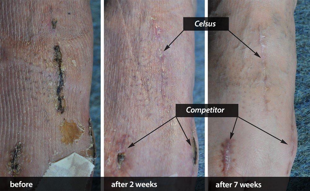 Scar Cream Competitor Comparison