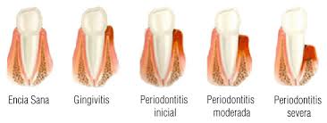 periodonciafuturedent1.jpg