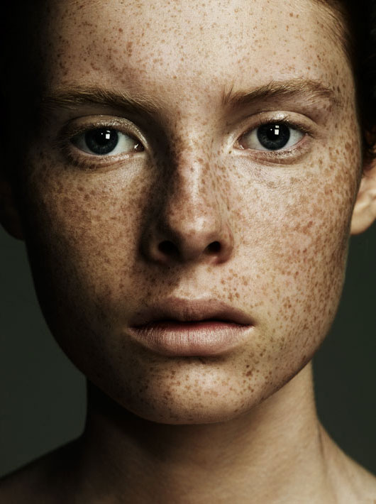 freckles-beauty-matthew-shave.jpg