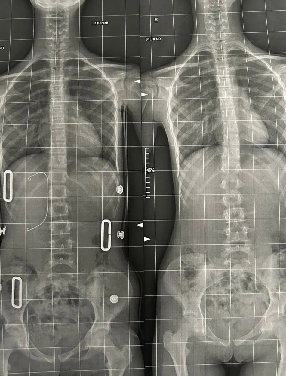 Röntgen 2.JPG