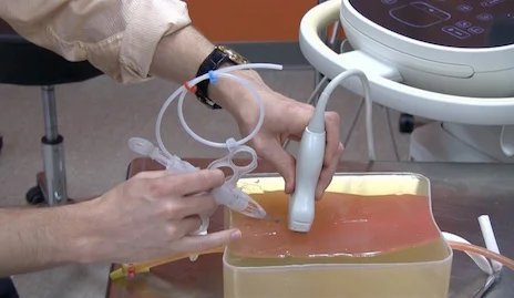 Yale start-up’s device makes a medical procedure a lot safer