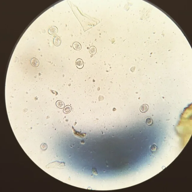  Example slide showing Coccidia during a fecal analysis