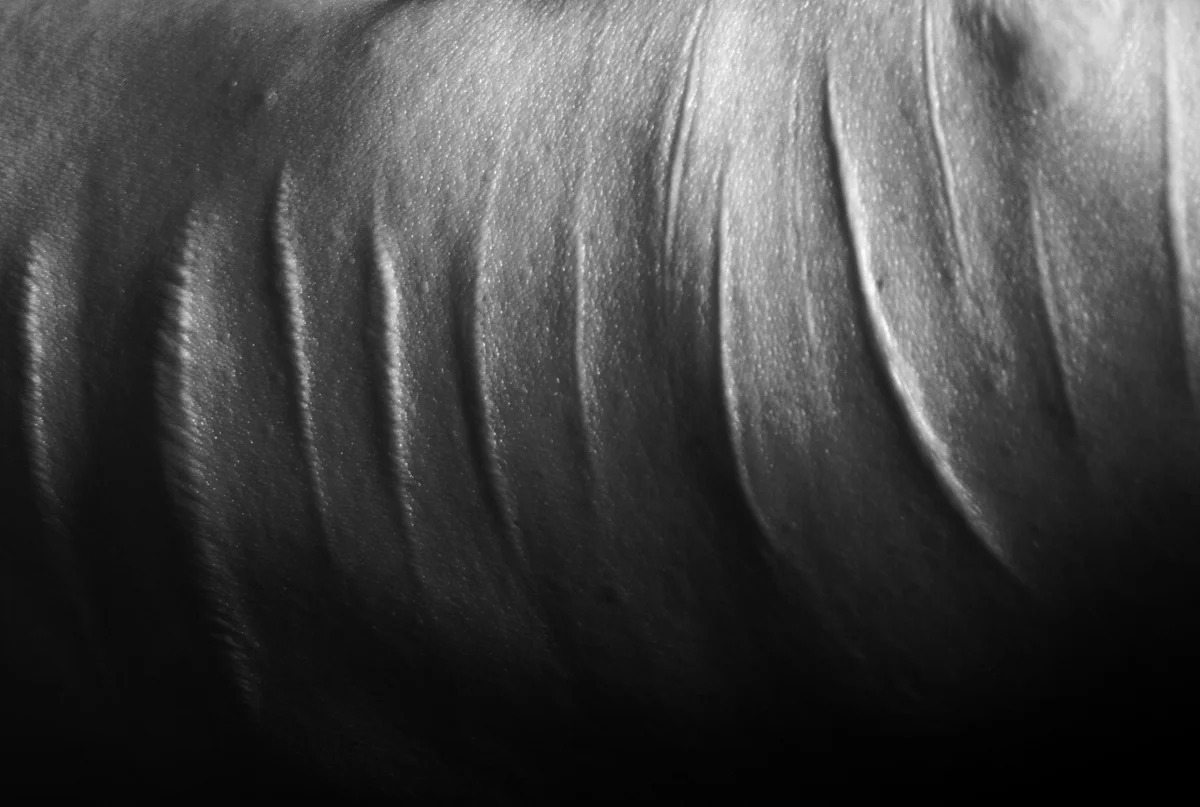 Pain (65 cuts, 4 burns)