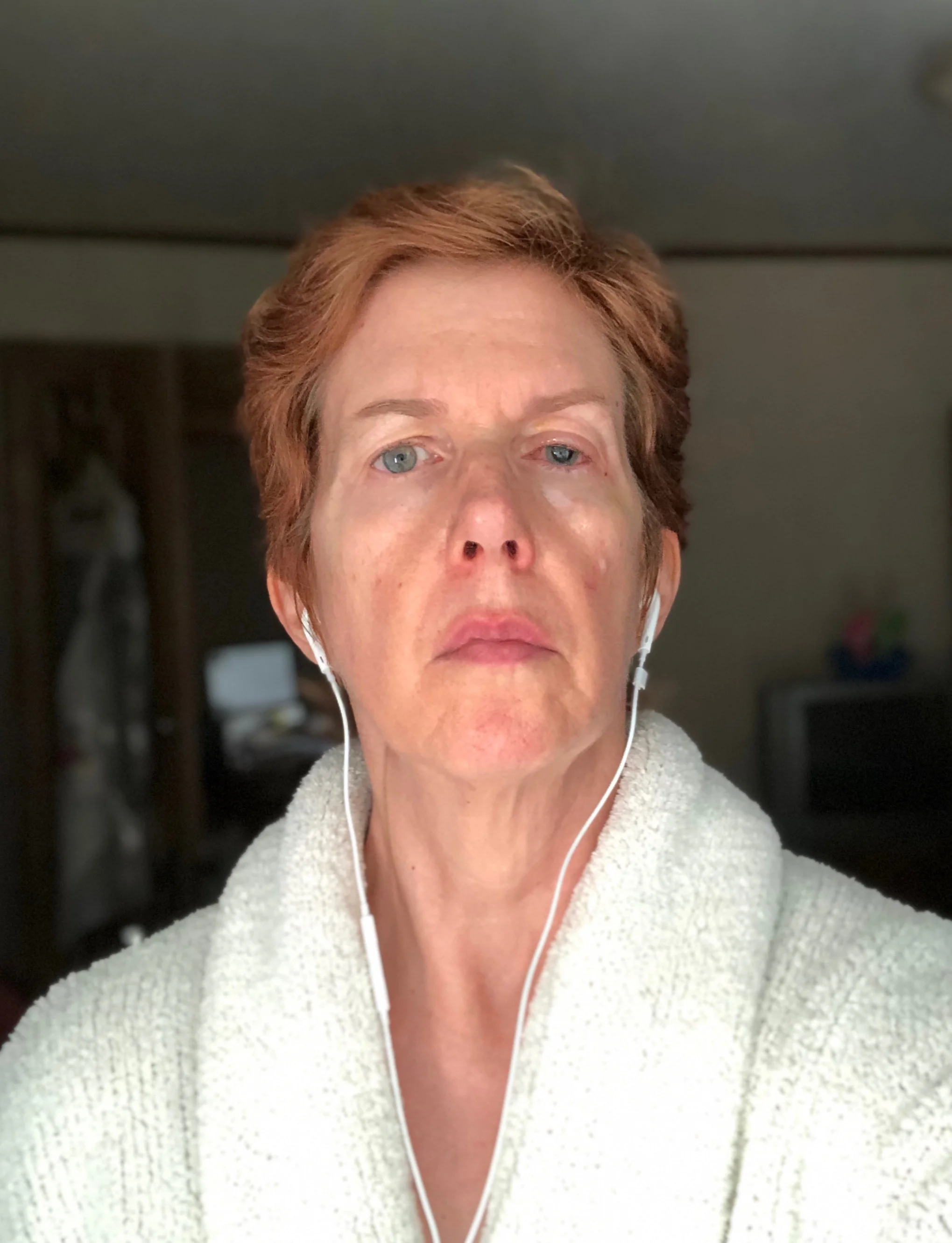 day20_swollen_waiting.jpg
