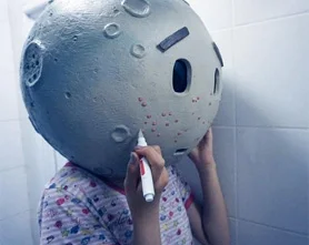 影响美观   原本光滑的脸变得坑坑洼洼，脸型再漂亮、眼睛再大，也跟漂亮无关。